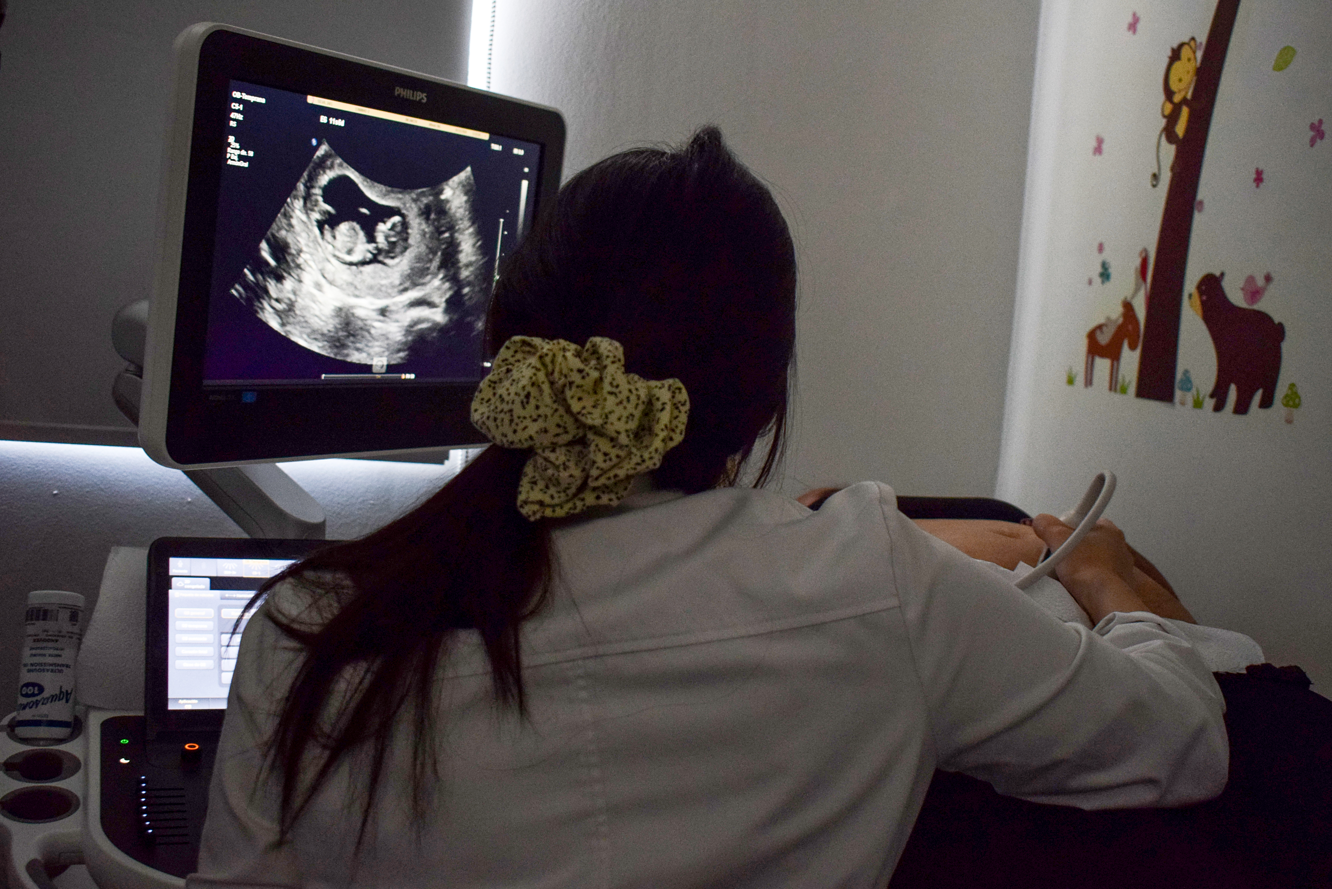 Modernas ecografías obstétricas en 3D y 4D se realizaron en operativo de salud colaborativo